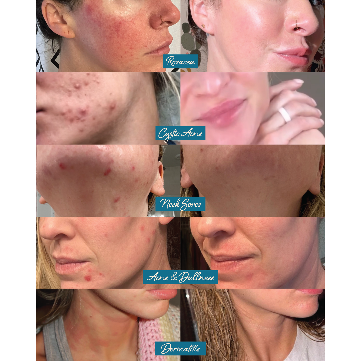 Tallow Face Balm | Natural Blue Tansy Skincare Moisturizer